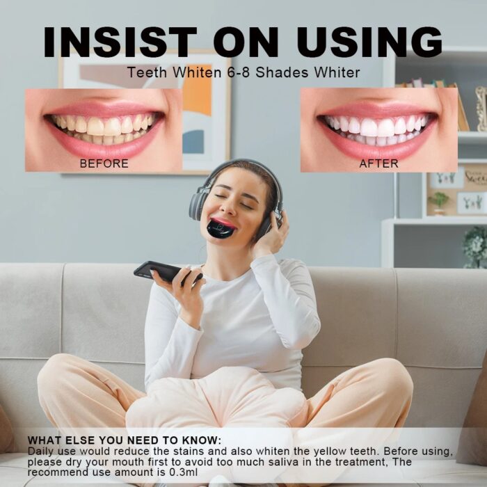 Teeth Whitening